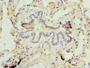 Immunohistochemistry of paraffin-embedded human lung tissue using CSB-PA237035ESR1HU at dilution of 1:100