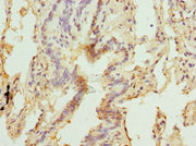 Immunohistochemistry of paraffin-embedded human lung tissue using CSB-PA237035ESR2HU at dilution of 1:100