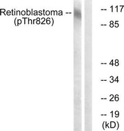 Western blot analysis of extracts from HepG2 cells, treated with nocodazole (1ug/ml, 16hours), using Retinoblastoma (Phospho-Thr826) antibody. The lane on the right is treated with the synthesized peptide.