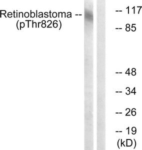 Western blot analysis of extracts from HepG2 cells, treated with nocodazole (1ug/ml, 16hours), using Retinoblastoma (Phospho-Thr826) antibody. The lane on the right is treated with the synthesized peptide.