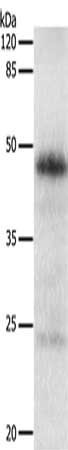 Gel: 10%SDS-PAGE, Lysate: 30 ug, Lane: Human lung cancer tissue, Primary antibody: CSB-PA237120(EDA Antibody) at dilution 1/130, Secondary antibody: Goat anti rabbit IgG at 1/8000 dilution, Exposure time: 5 minutes