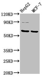 Western Blot Positive WB detected in: HepG2 whole cell lysate, MCF-7 whole cell lysate All lanes: FPGS antibody at 3.2µg/ml Secondary Goat polyclonal to rabbit IgG at 1/50000 dilution Predicted band size: 65, 61, 60, 62 kDa Observed band size: 65 kDa