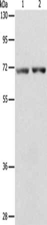 Gel: 8%SDS-PAGE, Lysate: 50 ug, Lane 1-2: Human liver cancer tissue, Human colon cancer tissue, Primary antibody: CSB-PA237241(STK39 Antibody) at dilution 1/800, Secondary antibody: Goat anti rabbit IgG at 1/8000 dilution, Exposure time: 1 minute