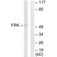 Western blot analysis of extracts from Jurkat cells, using FRK antibody.