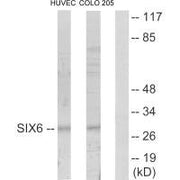 Western blot analysis of extracts from HUVEC cells and COLO205 cells, using SIX6 antibody.