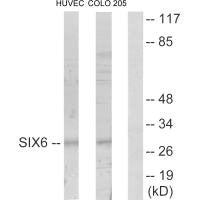 Western blot analysis of extracts from HUVEC cells and COLO205 cells, using SIX6 antibody.