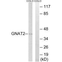 Western blot analysis of extracts from COLO cells, using GNAT2 antibody.