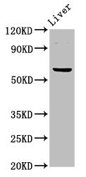 Western Blot Positive WB detected in: Mouse liver tissue All lanes: NT5C2 antibody at 3ug/ml Secondary Goat polyclonal to rabbit IgG at 1/50000 dilution Predicted band size: 65, 62 kDa Observed band size: 65 kDa