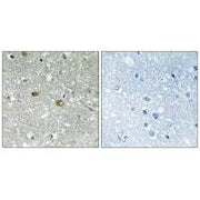 Immunohistochemistry analysis of paraffin-embedded human brain tissue using PIGH antibody.