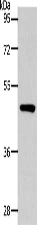 Gel: 10%SDS-PAGE, Lysate: 40 ug, Lane: Mouse kidney tissue, Primary antibody: CSB-PA238155(SLC16A14 Antibody) at dilution 1/300, Secondary antibody: Goat anti rabbit IgG at 1/8000 dilution, Exposure time: 90 seconds