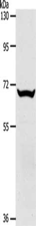 Gel: 10%SDS-PAGE, Lysate: 40 ug, Lane: Mouse liver tissue, Primary antibody: CSB-PA238172(SLC33A1 Antibody) at dilution 1/700, Secondary antibody: Goat anti rabbit IgG at 1/8000 dilution, Exposure time: 1 minute
