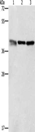 Gel: 12%SDS-PAGE, Lysate: 40 ug, Lane 1-3: A549 cells, K562 cells, PC3 cells, Primary antibody: CSB-PA238285(ZFP42 Antibody) at dilution 1/500, Secondary antibody: Goat anti rabbit IgG at 1/8000 dilution, Exposure time: 30 seconds
