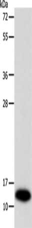 Gel: 12%SDS-PAGE, Lysate: 40 ug, Lane: Mouse liver tissue, Primary antibody: CSB-PA238446(SOD1 Antibody) at dilution 1/1160, Secondary antibody: Goat anti rabbit IgG at 1/8000 dilution, Exposure time: 45 seconds