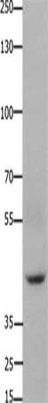 Gel: 8%SDS-PAGE, Lysate: 40 ug, Lane: 293T cells, Primary antibody: CSB-PA238725(FOXD3 Antibody) at dilution 1/650, Secondary antibody: Goat anti rabbit IgG at 1/8000 dilution, Exposure time: 1 minute