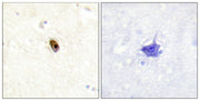 Immunohistochemistry analysis of paraffin-embedded human brain tissue using AurB/C (Phospho-Thr236/202) antibody. The picture on the right is treated with the synthesized peptide.