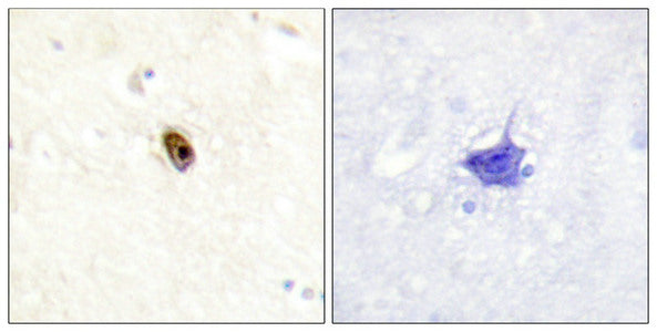 Immunohistochemistry analysis of paraffin-embedded human brain tissue using AurB/C (Phospho-Thr236/202) antibody. The picture on the right is treated with the synthesized peptide.