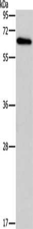 Gel: 10%SDS-PAGE, Lysate: 40 ug, Lane: Raji cells, Primary antibody: CSB-PA238810(BIN1 Antibody) at dilution 1/250, Secondary antibody: Goat anti rabbit IgG at 1/8000 dilution, Exposure time: 30 seconds