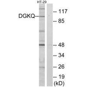 Western blot analysis of extracts from HT-29 cells, using DGKQ antibody.