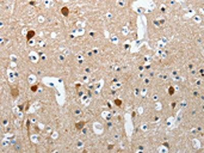 The image on the left is immunohistochemistry of paraffin-embedded Human brain tissue using CSB-PA239101(RCAN2 Antibody) at dilution 1/20, on the right is treated with synthetic peptide. (Original magnification: ×200)