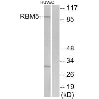 Western blot analysis of extracts from HUVEC cells, using RBM5 antibody.
