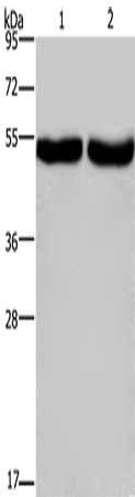 Gel: 8%SDS-PAGE, Lysate: 40 ug, Lane 1-2: Human colon cancer tissue, Human placenta tissue, Primary antibody: CSB-PA239685(CXCR1 Antibody) at dilution 1/200, Secondary antibody: Goat anti rabbit IgG at 1/8000 dilution, Exposure time: 2 minutes