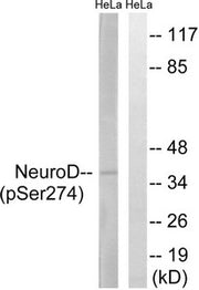 Western blot analysis of extracts from HeLa cells treated with UV using Neuro D (Phospho-Ser274) Antibody.The lane on the right is treated with the antigen-specific peptide.