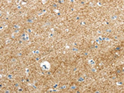 The image on the left is immunohistochemistry of paraffin-embedded Human brain tissue using CSB-PA240065(VAMP1 Antibody) at dilution 1/35, on the right is treated with synthetic peptide. (Original magnification: ×200)