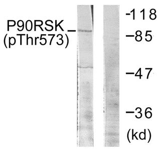 Western blot analysis of extracts from 293 cells treated with UV using p90 RSK (Phospho-Thr573) Antibody.The lane on the right is treated with the antigen-specific peptide.