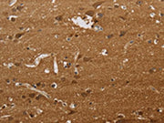 The image on the left is immunohistochemistry of paraffin-embedded Human brain tissue using CSB-PA240124(ELAVL2 Antibody) at dilution 1/40, on the right is treated with synthetic peptide. (Original magnification: ×200)