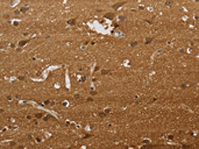 The image on the left is immunohistochemistry of paraffin-embedded Human brain tissue using CSB-PA240124(ELAVL2 Antibody) at dilution 1/40, on the right is treated with synthetic peptide. (Original magnification: ×200)