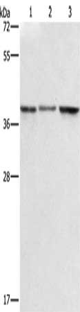 Gel: 12%SDS-PAGE, Lysate: 40 ug, Lane 1-3: A549 cells, K562 cells, PC3 cells, Primary antibody: CSB-PA240134(ZFP42 Antibody) at dilution 1/500, Secondary antibody: Goat anti rabbit IgG at 1/8000 dilution, Exposure time: 30 seconds