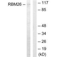 Western blot analysis of extracts from Jurkat cells, using RBM26 antibody.