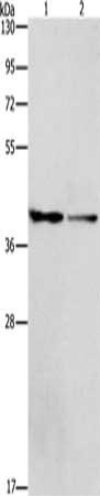 Gel: 8%SDS-PAGE, Lysate: 40 ug, Lane 1-2: 293T cells, hela cells, Primary antibody: CSB-PA240234(ACP2 Antibody) at dilution 1/400, Secondary antibody: Goat anti rabbit IgG at 1/8000 dilution, Exposure time: 3 minutes