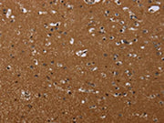 The image on the left is immunohistochemistry of paraffin-embedded Human brain tissue using CSB-PA240239(MOB1A Antibody) at dilution 1/20, on the right is treated with synthetic peptide. (Original magnification: ×200)