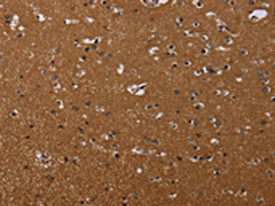 The image on the left is immunohistochemistry of paraffin-embedded Human brain tissue using CSB-PA240239(MOB1A Antibody) at dilution 1/20, on the right is treated with synthetic peptide. (Original magnification: ×200)
