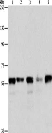 Gel: 8%SDS-PAGE, Lysate: 40 ug, Lane 1-5: Hela cells, Jurkat cells, 293T cells, K562 cells, mouse testis tissue, Primary antibody: CSB-PA240267(ARIH2 Antibody) at dilution 1/550, Secondary antibody: Goat anti rabbit IgG at 1/8000 dilution, Exposur...