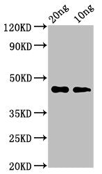 Western Blot Positive WB detected in Recombinant protein All lanes: cas3 antibody at 3.2µg/ml Secondary Goat polyclonal to rabbit IgG at 1/50000 dilution Predicted band size: 45 kDa Observed band size: 45 kDa