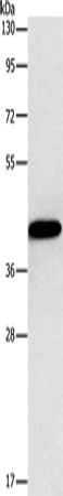 Gel: 8%SDS-PAGE, Lysate: 40 ug, Lane: MCF7 cells, Primary antibody: CSB-PA240417(GJC1 Antibody) at dilution 1/1250, Secondary antibody: Goat anti rabbit IgG at 1/8000 dilution, Exposure time: 5 seconds