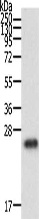 Gel: 12%SDS-PAGE, Lysate: 40 ug, Lane: Human fetal brain tissue, Primary antibody: CSB-PA240574(RAC1 Antibody) at dilution 1/500, Secondary antibody: Goat anti rabbit IgG at 1/8000 dilution, Exposure time: 1 minute
