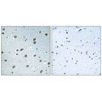 Immunohistochemistry analysis of paraffin-embedded human brain tissue using KLHL29 antibody.