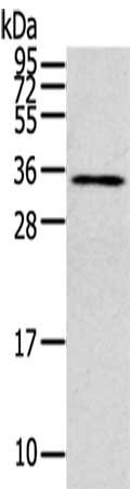 Gel: 12%SDS-PAGE,Lysate: 40 ug,,Primary antibody: CSB-PA240685(CLIC4 Antibody) at dilution 1/200 dilution,Secondary antibody: Goat anti rabbit IgG at 1/8000 dilution,Exposure time: 10 seconds