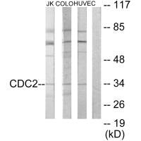 Western blot analysis of extracts from Jurkat cells, COLO205 cells and HUVEC, using CDC2 antibody.