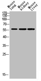 Western blot analysis of mouse-lung mouse-brain mouse-heart Hela mouse-liver lysate, antibody was diluted at 500. Secondary antibody was diluted at 1:20000