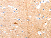 The image on the left is immunohistochemistry of paraffin-embedded Human brain tissue using CSB-PA241224(GPR3 Antibody) at dilution 1/55, on the right is treated with synthetic peptide. (Original magnification: ×200)