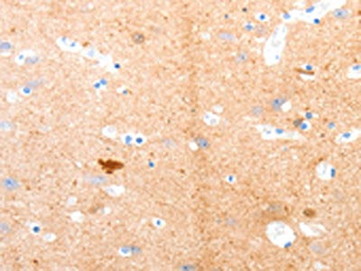 The image on the left is immunohistochemistry of paraffin-embedded Human brain tissue using CSB-PA241224(GPR3 Antibody) at dilution 1/55, on the right is treated with synthetic peptide. (Original magnification: ×200)