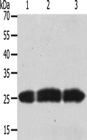 Gel: 8+12%SDS-PAGE, Lysate: 50 ug, Lane 1-3: Human brain tissue, PC3 cells, hela cells, Primary antibody: CSB-PA241266(TIMP4 Antibody) at dilution 1/200, Secondary antibody: Goat anti rabbit IgG at 1/8000 dilution, Exposure time: 30 seconds