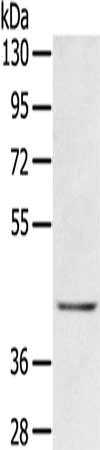 Gel: 8%SDS-PAGE, Lysate: 40 ug, Lane: Jurkat cells, Primary antibody: CSB-PA241502(EGR3 Antibody) at dilution 1/300, Secondary antibody: Goat anti rabbit IgG at 1/8000 dilution, Exposure time: 3 minutes