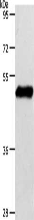 Gel: 10%SDS-PAGE, Lysate: 40 ug, Lane: Mouse brain tissue, Primary antibody: CSB-PA241754(S1PR1 Antibody) at dilution 1/750, Secondary antibody: Goat anti rabbit IgG at 1/8000 dilution, Exposure time: 10 seconds