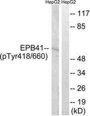 Western blot analysis of extracts from HepG2 cells treated with PMA using EPB41 (Phospho-Tyr660/418) Antibody.The lane on the right is treated with the antigen-specific peptide.
