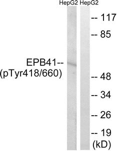 Western blot analysis of extracts from HepG2 cells treated with PMA using EPB41 (Phospho-Tyr660/418) Antibody.The lane on the right is treated with the antigen-specific peptide.